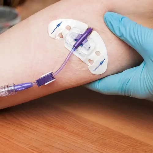 Are PICC Lines and Midline Catheters Safe? Risks and Legal Options